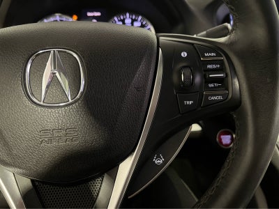 2017 Acura TLX P-AWS with Technology Package